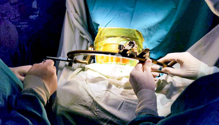 se-realizo-en-el-hospital-san-martin-de-parana-una-cirugia-inedita-para-el-tratamiento-del-parkinson-001
